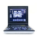 Laptop ultrasound instrument for livers of Maine cats